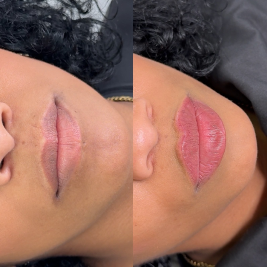 Classic Augmentation · Before & After